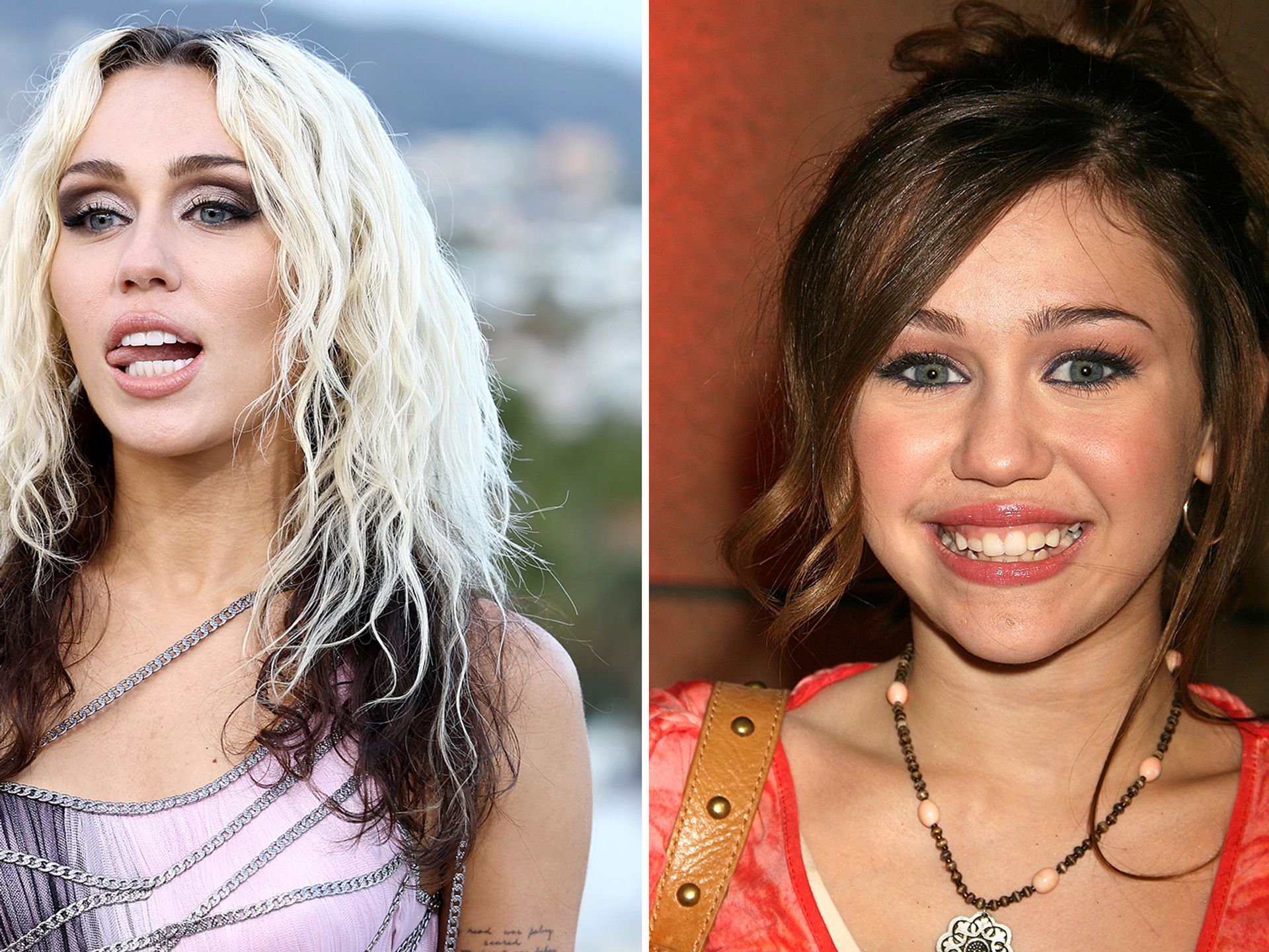 miley cyrus teeth before after