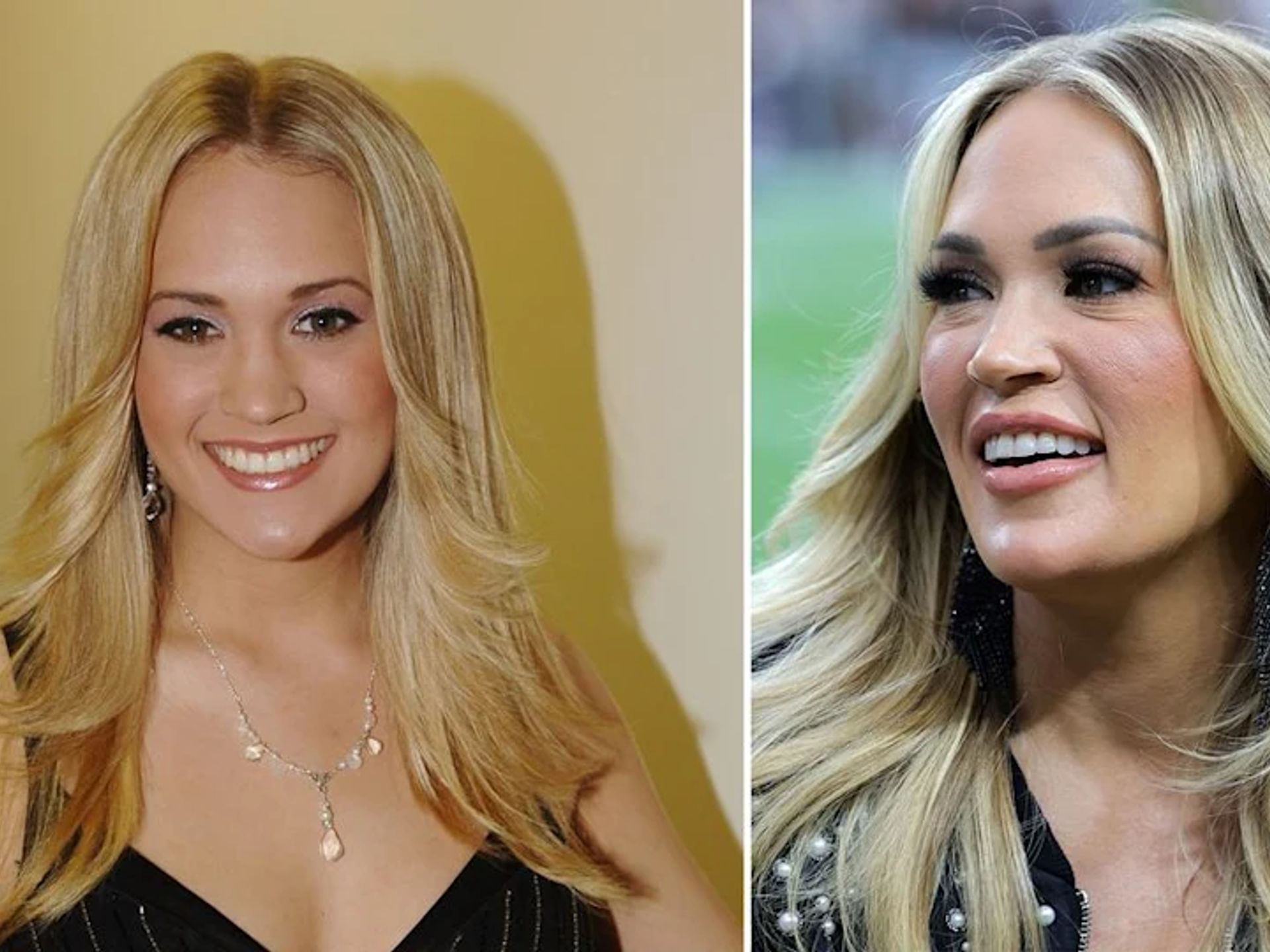 Carrie Underwood Before And After