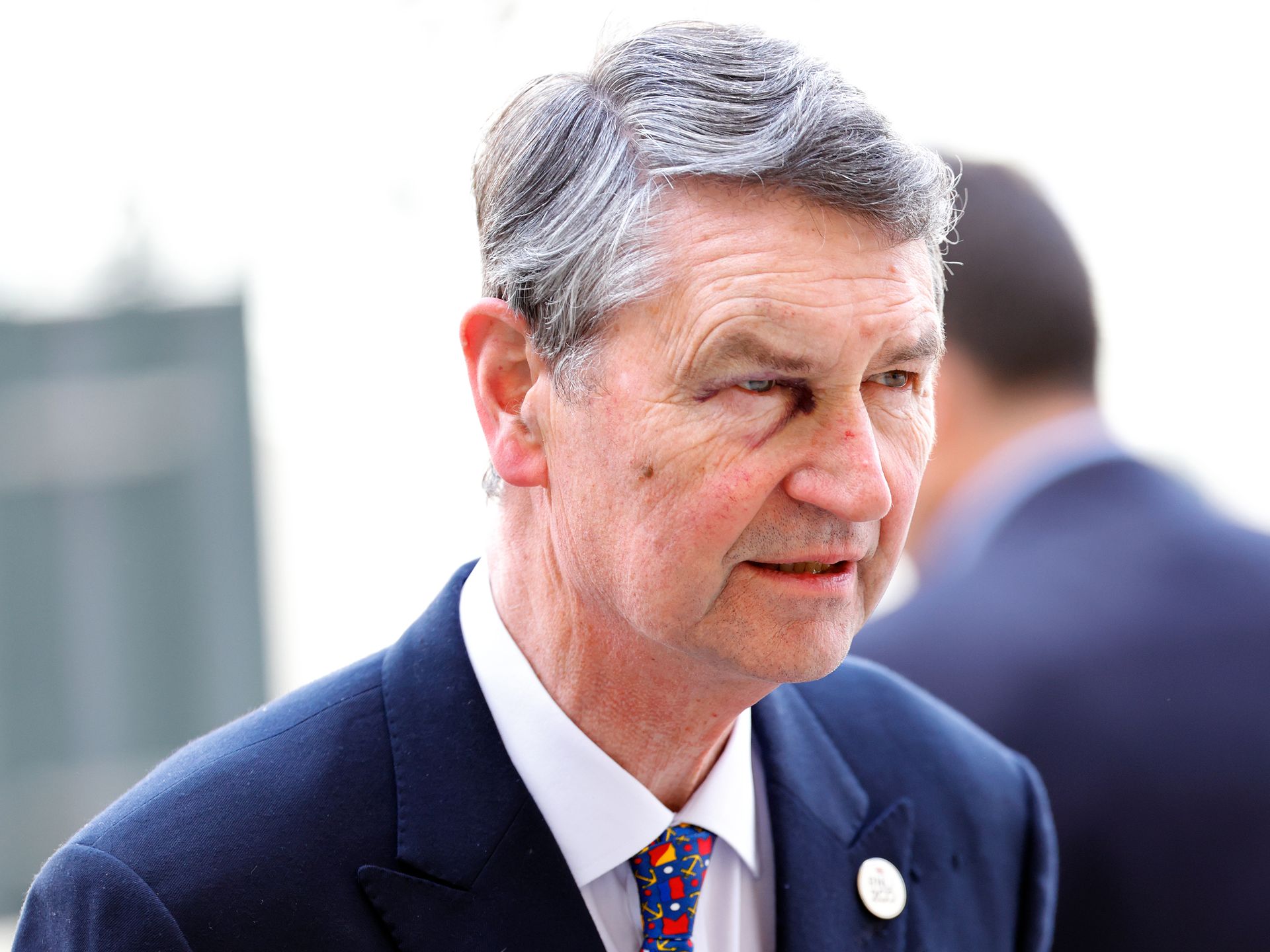 Princess Anne's husband Tim Laurence sports facial injury - cause revealed | HELLO!