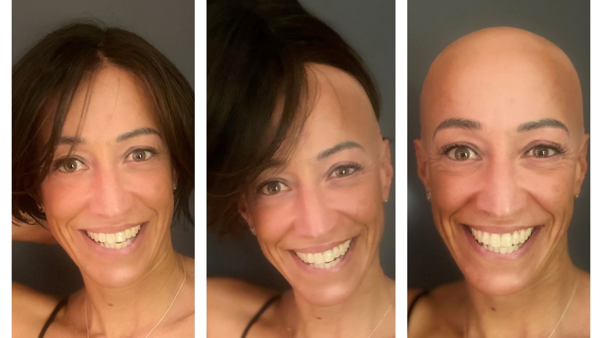 Collage of a woman abandoning her wig