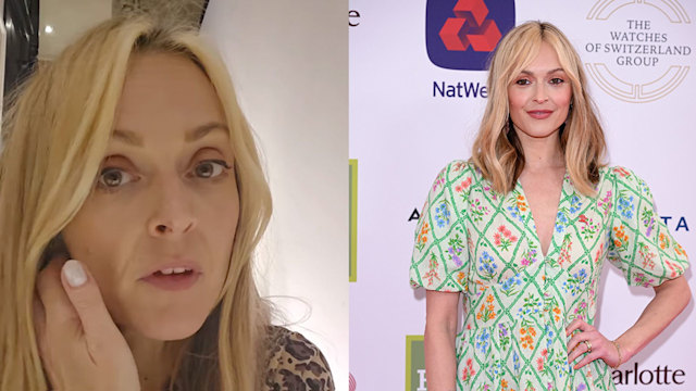 Fearne Cotton tumour