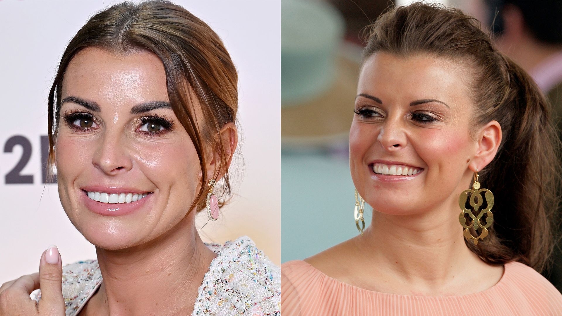 Coleen Rooney’s teeth transformation: WAG-tastic new smile revealed