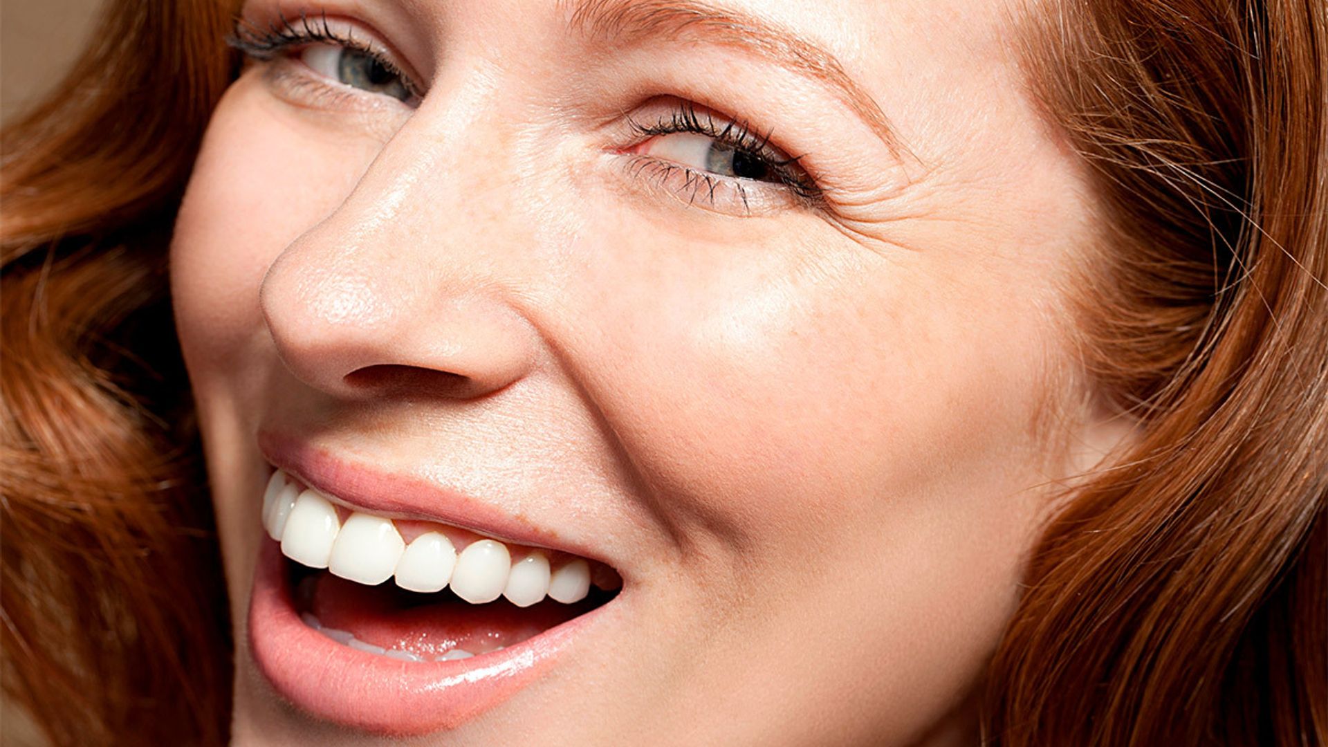 smiletime teeth whitening