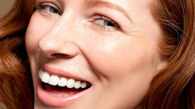 smiletime teeth whitening