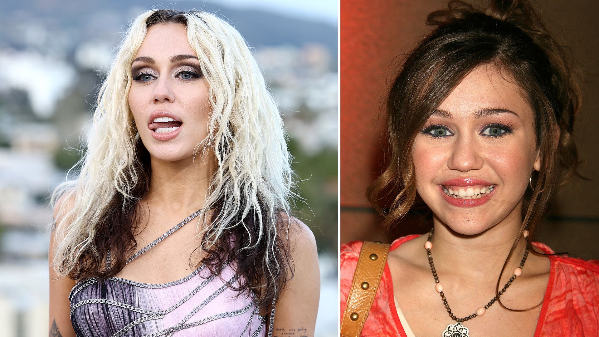 Miley Cyrus before and after her smile makeover