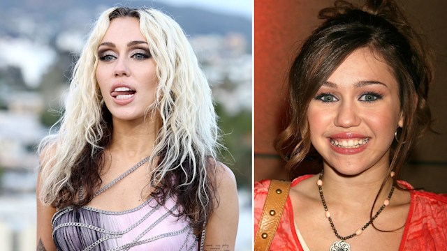 Miley Cyrus before and after her smile makeover