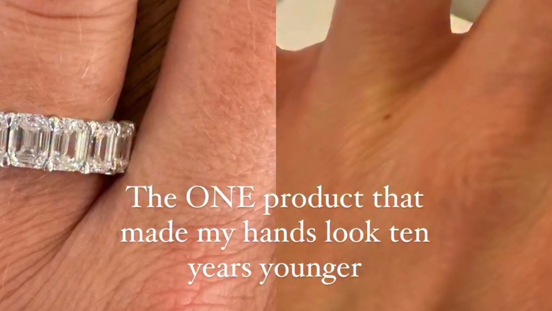 erin donahue hands before and after