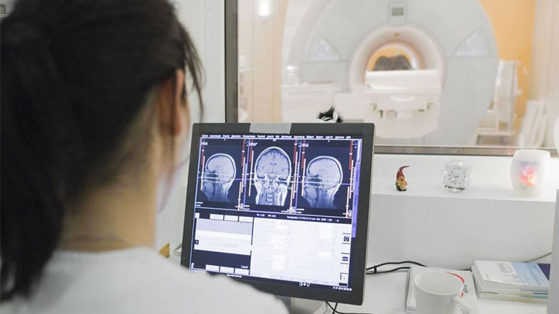 doctor brain scan