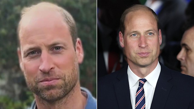 Prince William with stubble (left) and clean-shaven (right)