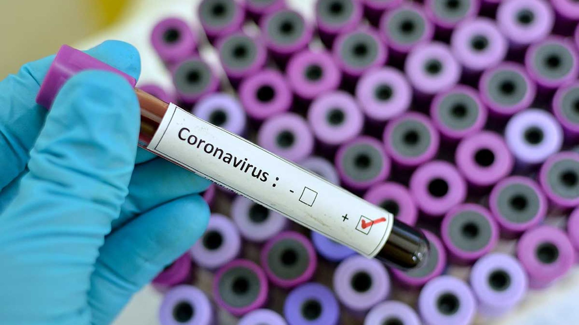 coronavirus test tube