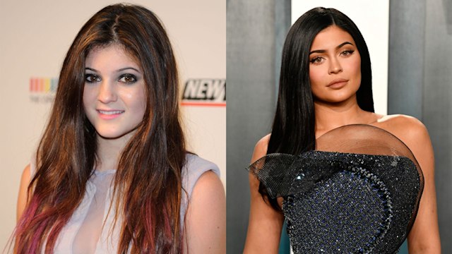 Left: Kylie Jenner in 2011 Right: Kylie Jenner in 2020