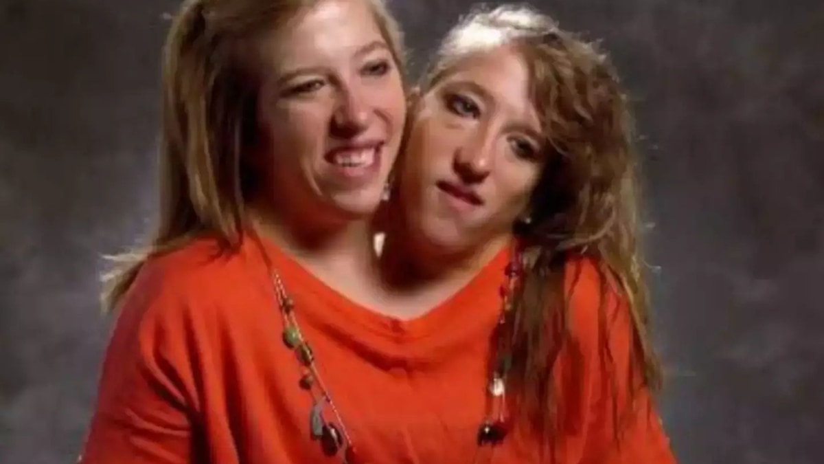 Conjoined twins Abby and Brittany Hensel reveal surprising details
