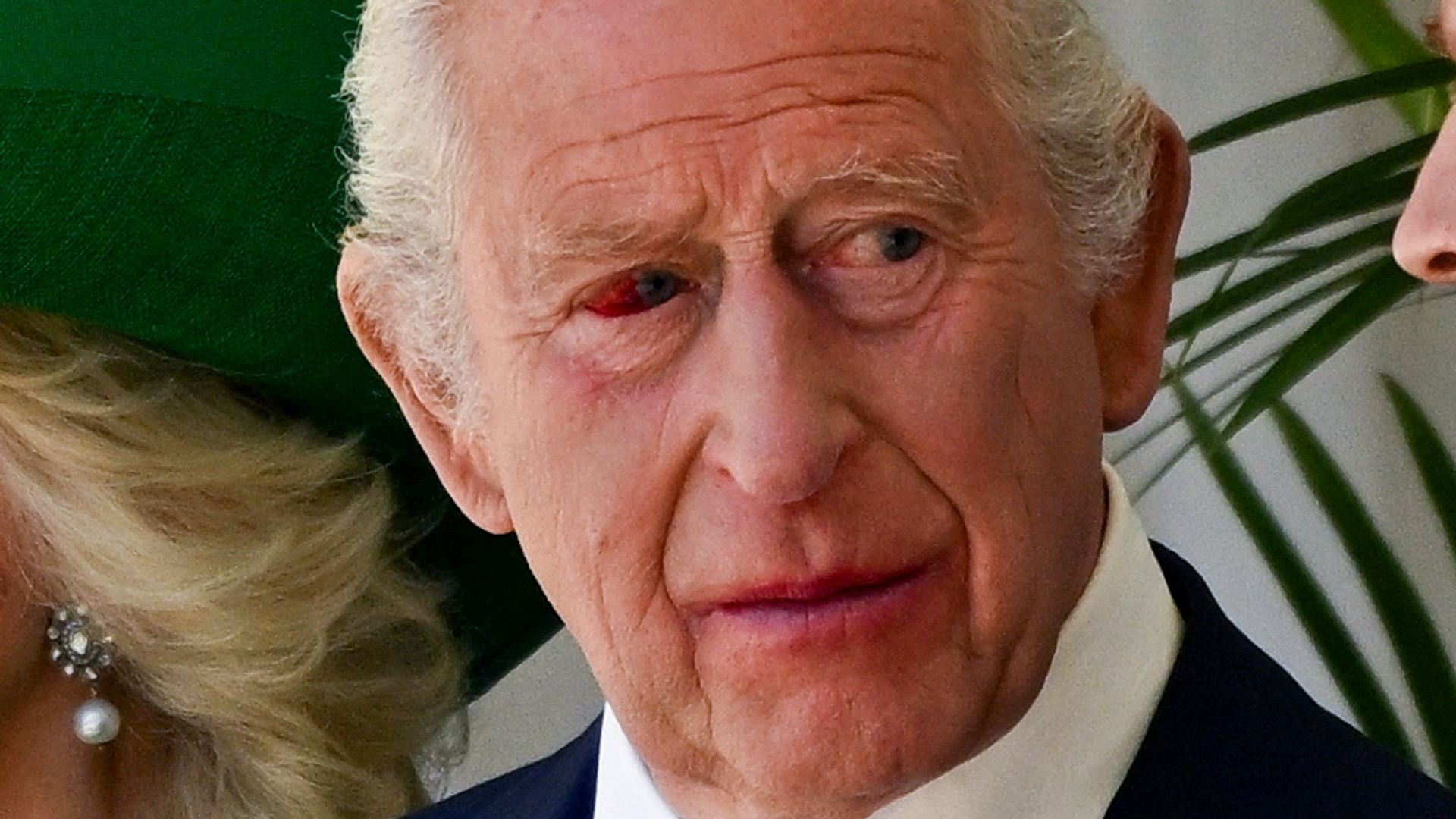 King Charles with President Macron with a very sore eye