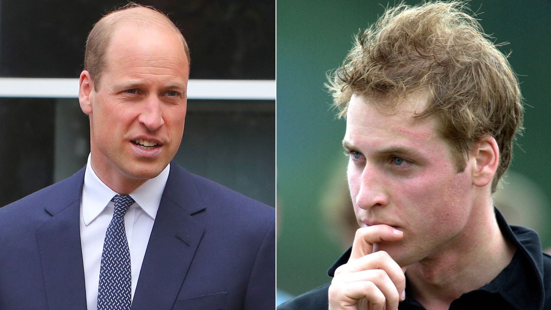 Prince William in Wales and with scar visible 