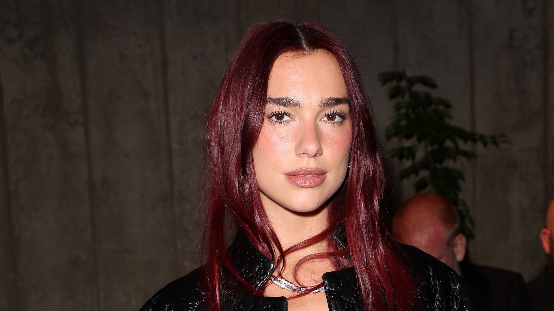 Dua Lipa showcases her legs covered with bruises in new photo