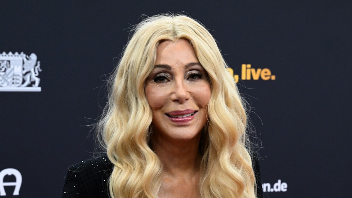Cher, 79, shares unexpected health update on TODAY in surprise on-air call