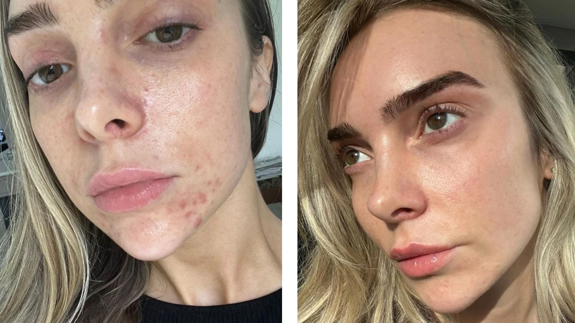 The £39.99 ‘Miracle Skin’ treatment shoppers describe as ‘unreal’ and ‘unbelievable’ 