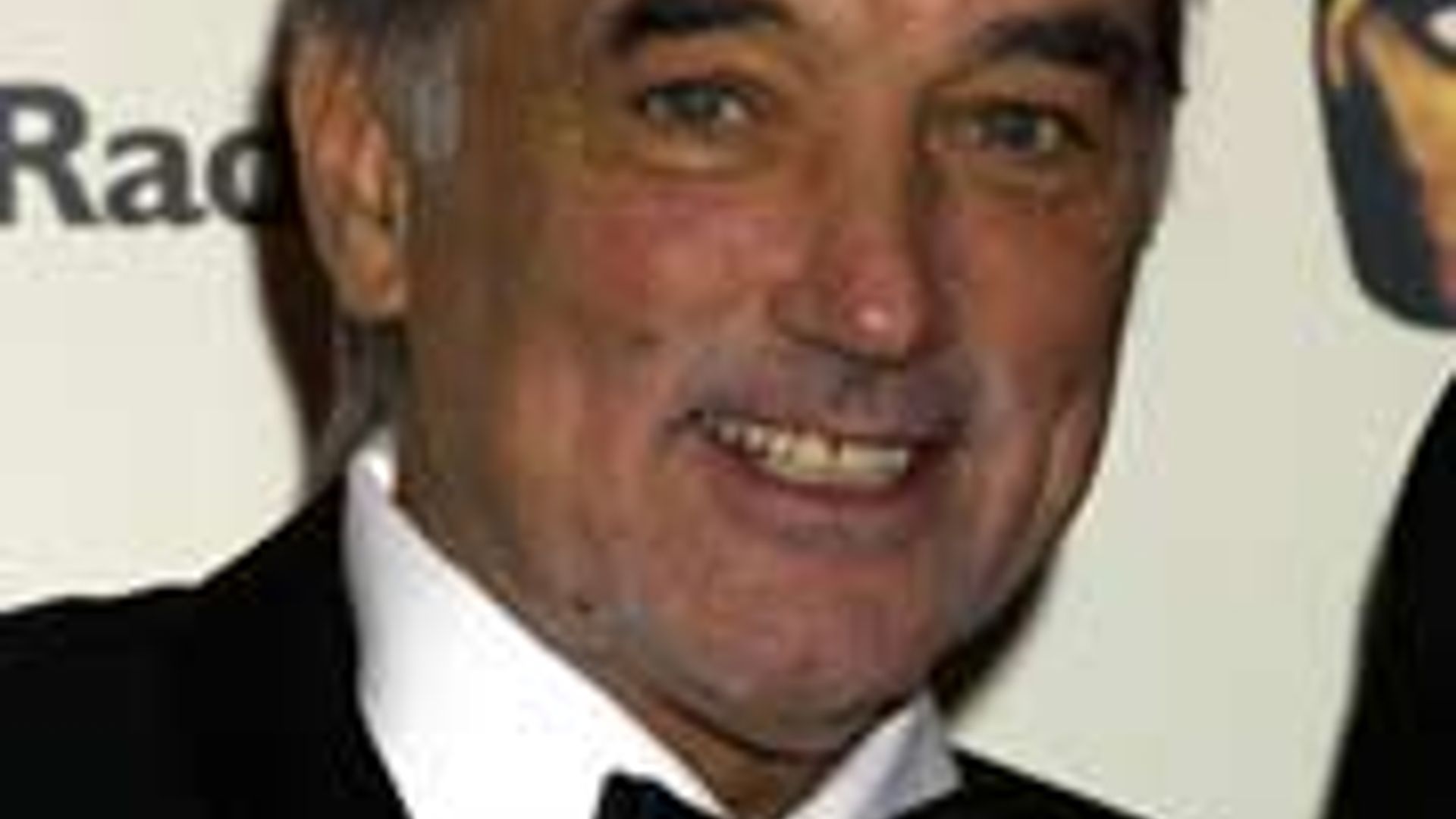 FOOTBALL LEGEND BEST UNDERGOES LIVER TRANSPLANT HELLO!