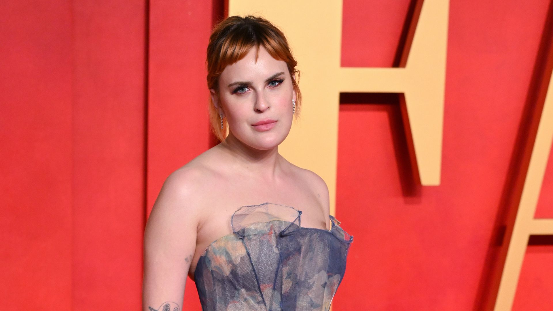 Tallulah Willis reveals 'real' appearance after having fillers dissolved in glowing selfie