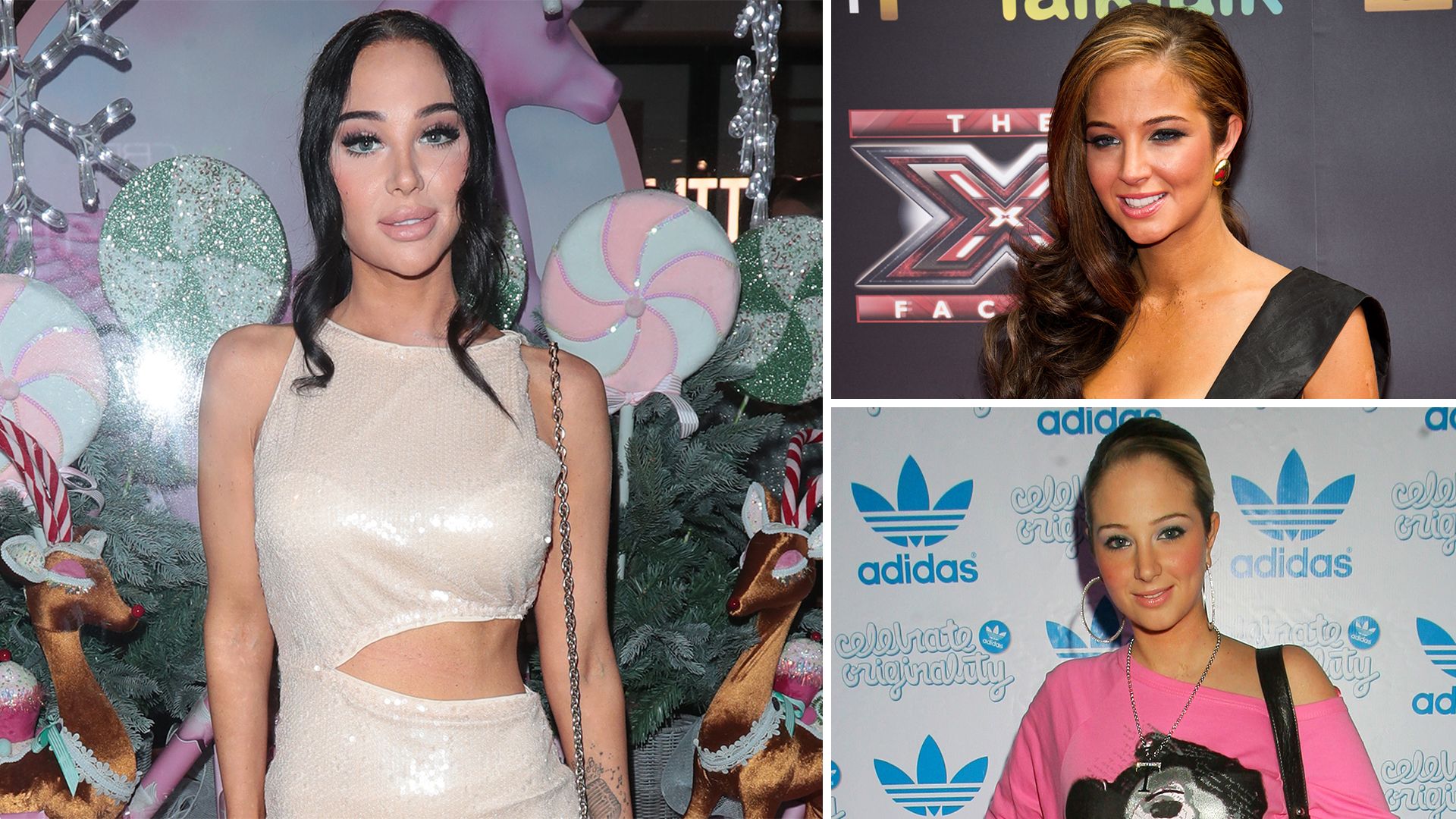 Tulisa’s facial surgery ‘confession’: what has star done to her face