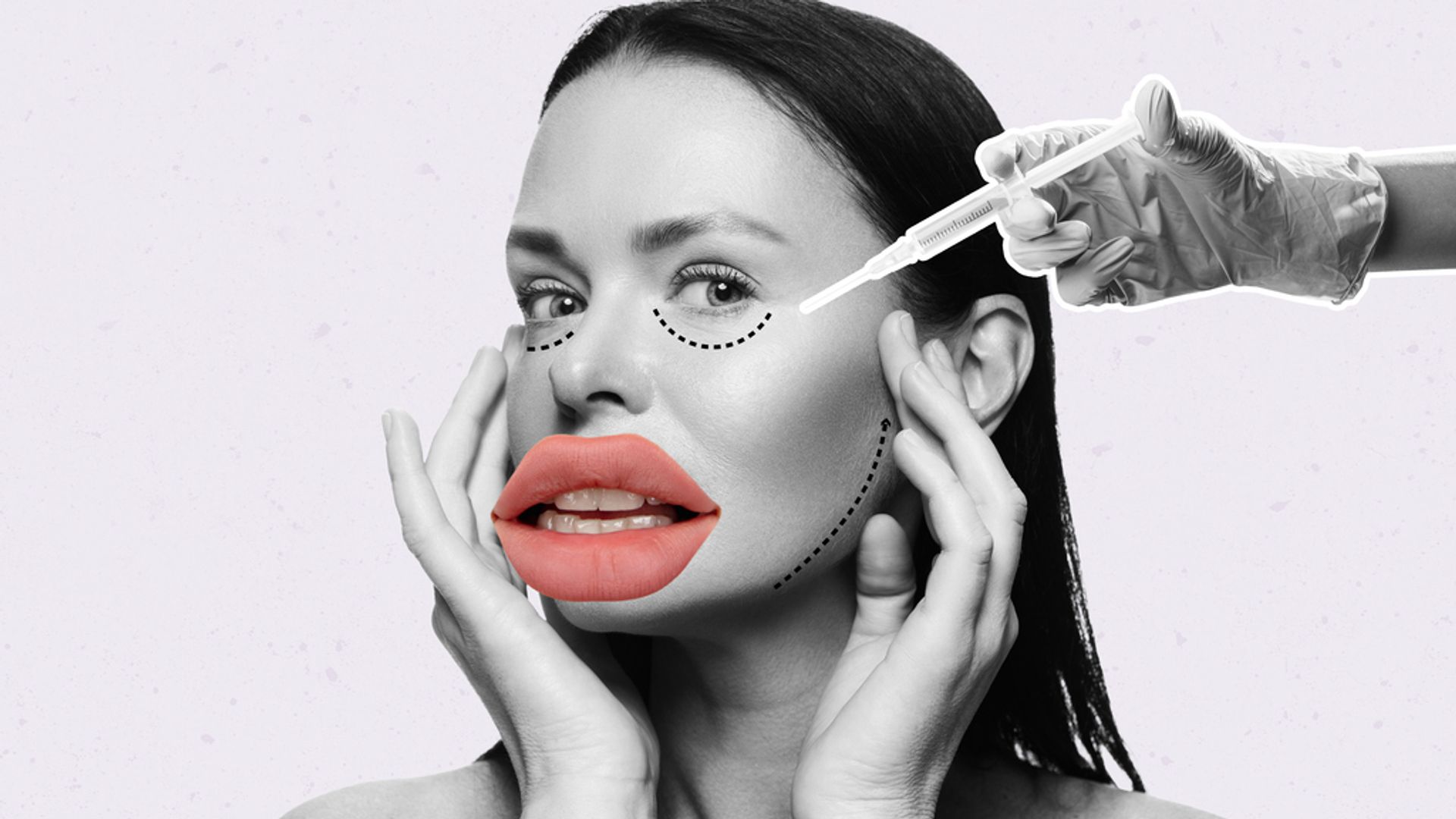 Contemporary art collage. Woman doing face lifting with hyaluronic acid fillers. Anti aging care. Lip augmentation