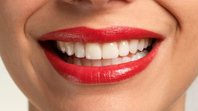 teeth whitening red lipstick