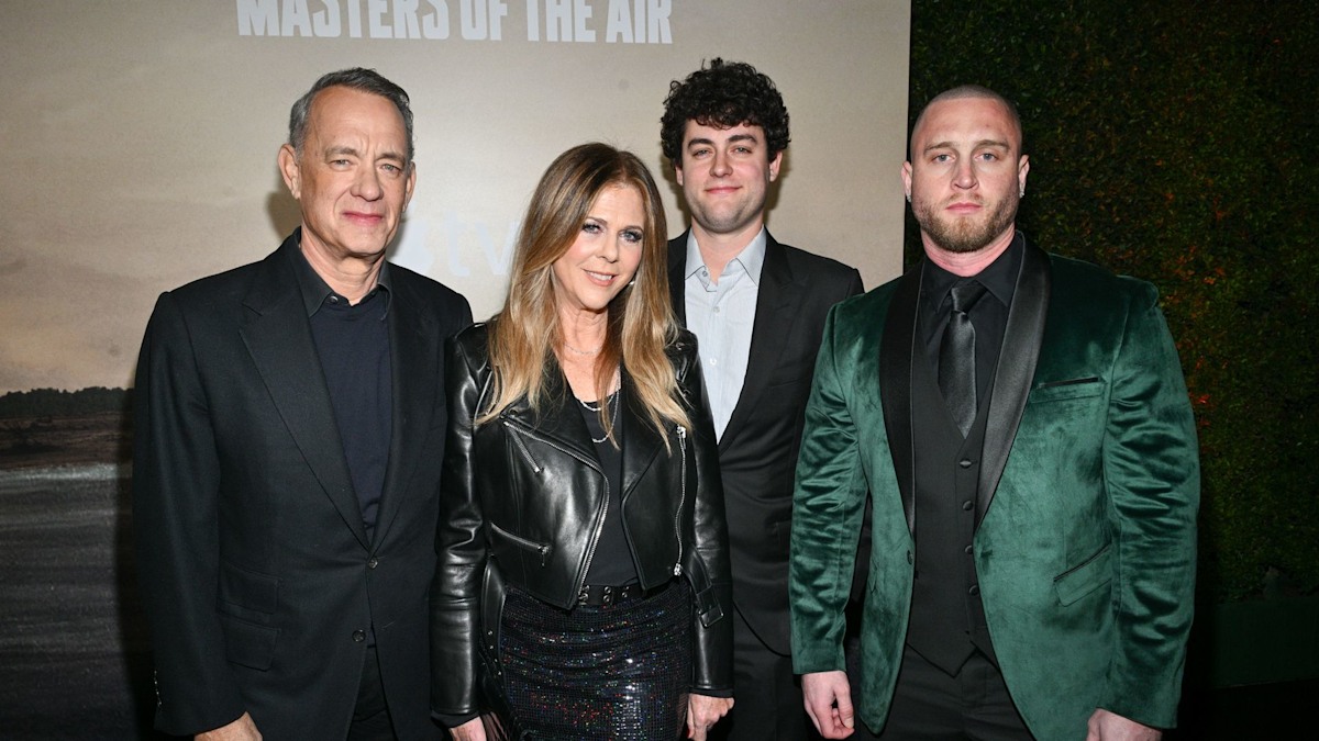 Tom Hanks' famous son shares results of cosmetic procedure: 'No shame ...