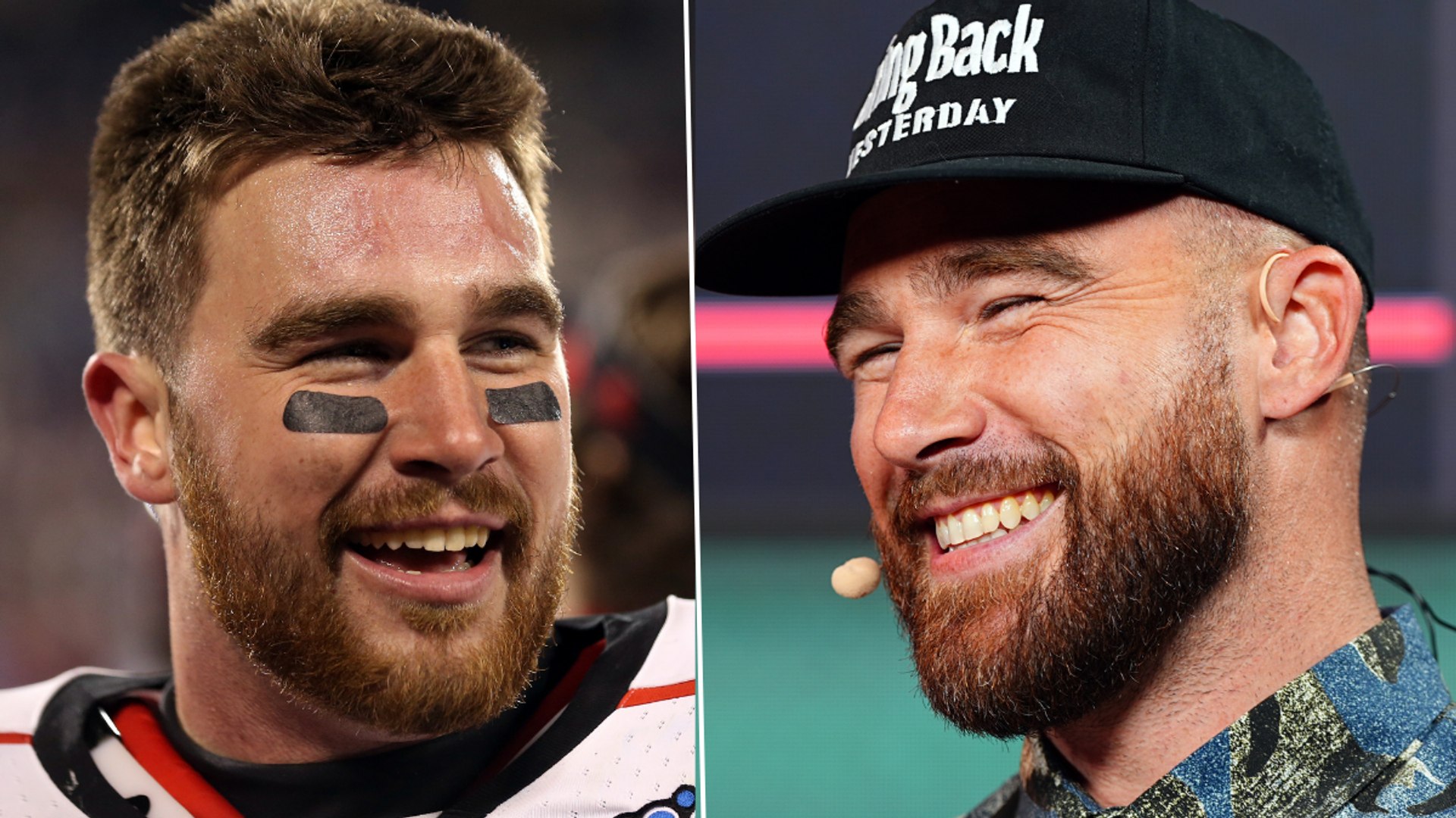 Travis Kelce's teeth: before and after 