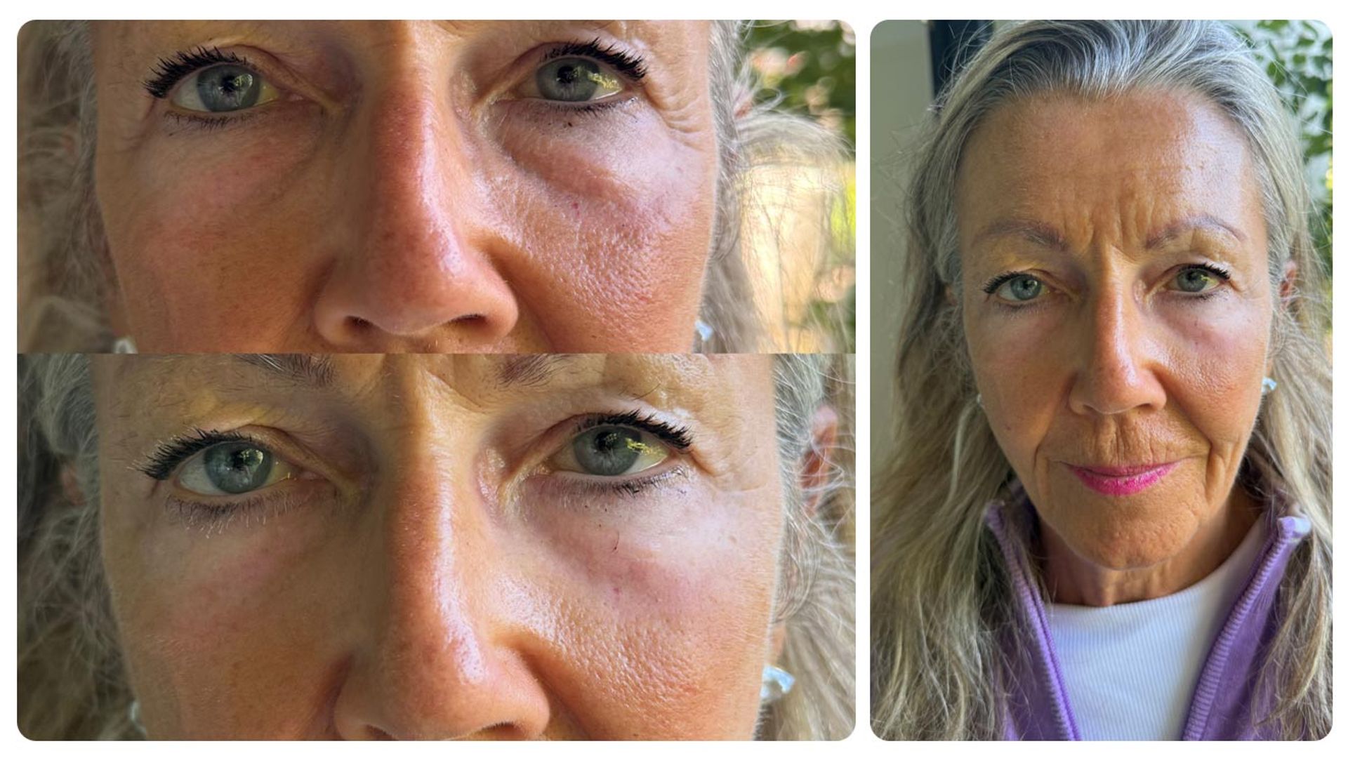 Leila Poleszczuk's mother in law before and after photo