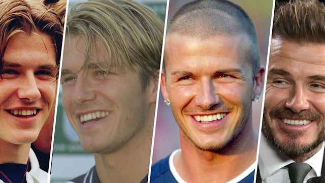 David Beckham's teeth throughout the years