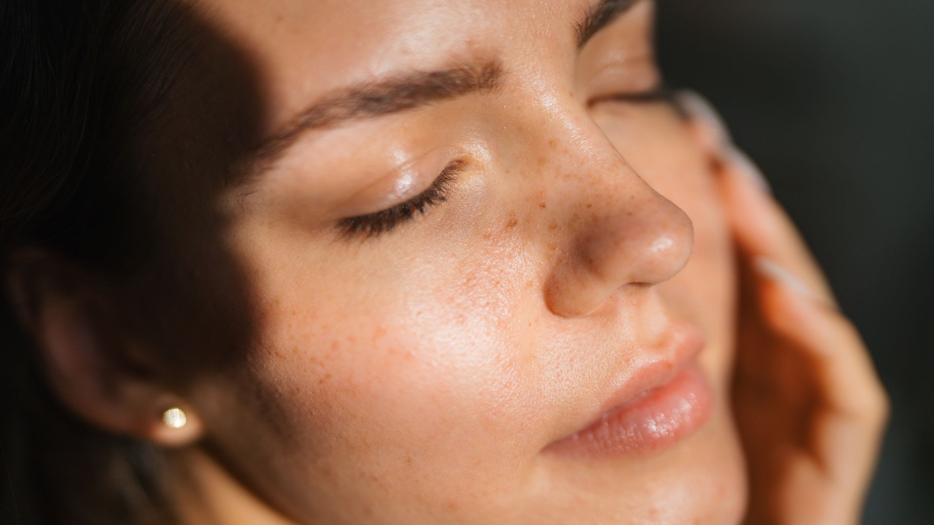 This 'preventative' laser treatment took me back to my 20-year-old skin