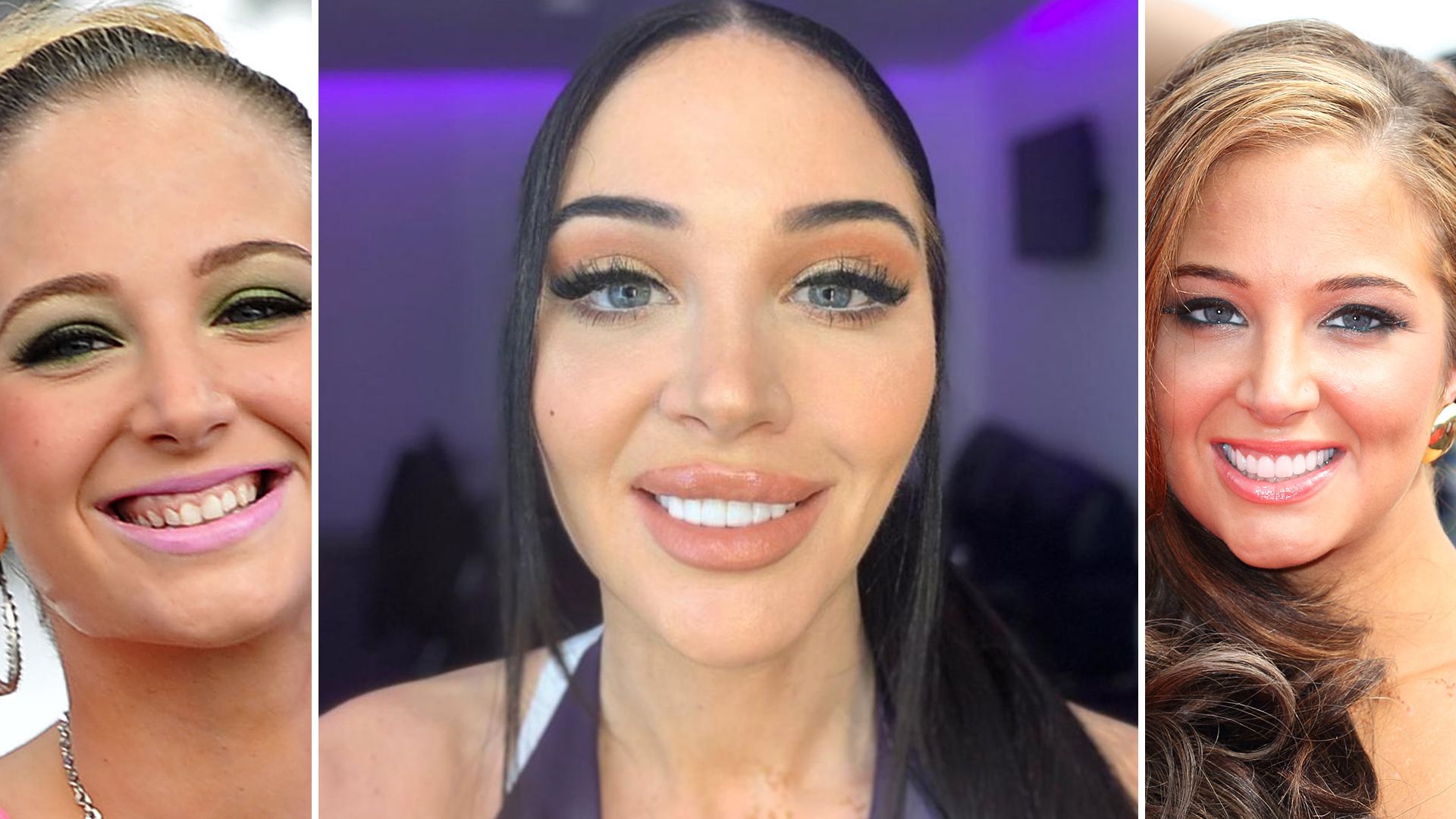 Tulisa’s 12k teeth transformation after ‘stressing’ about smile