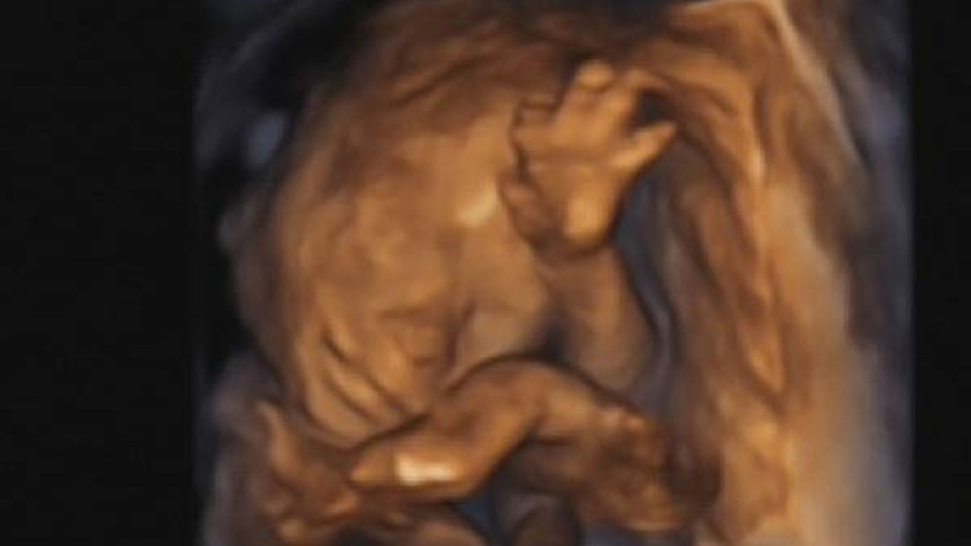 caterina ultrasound 