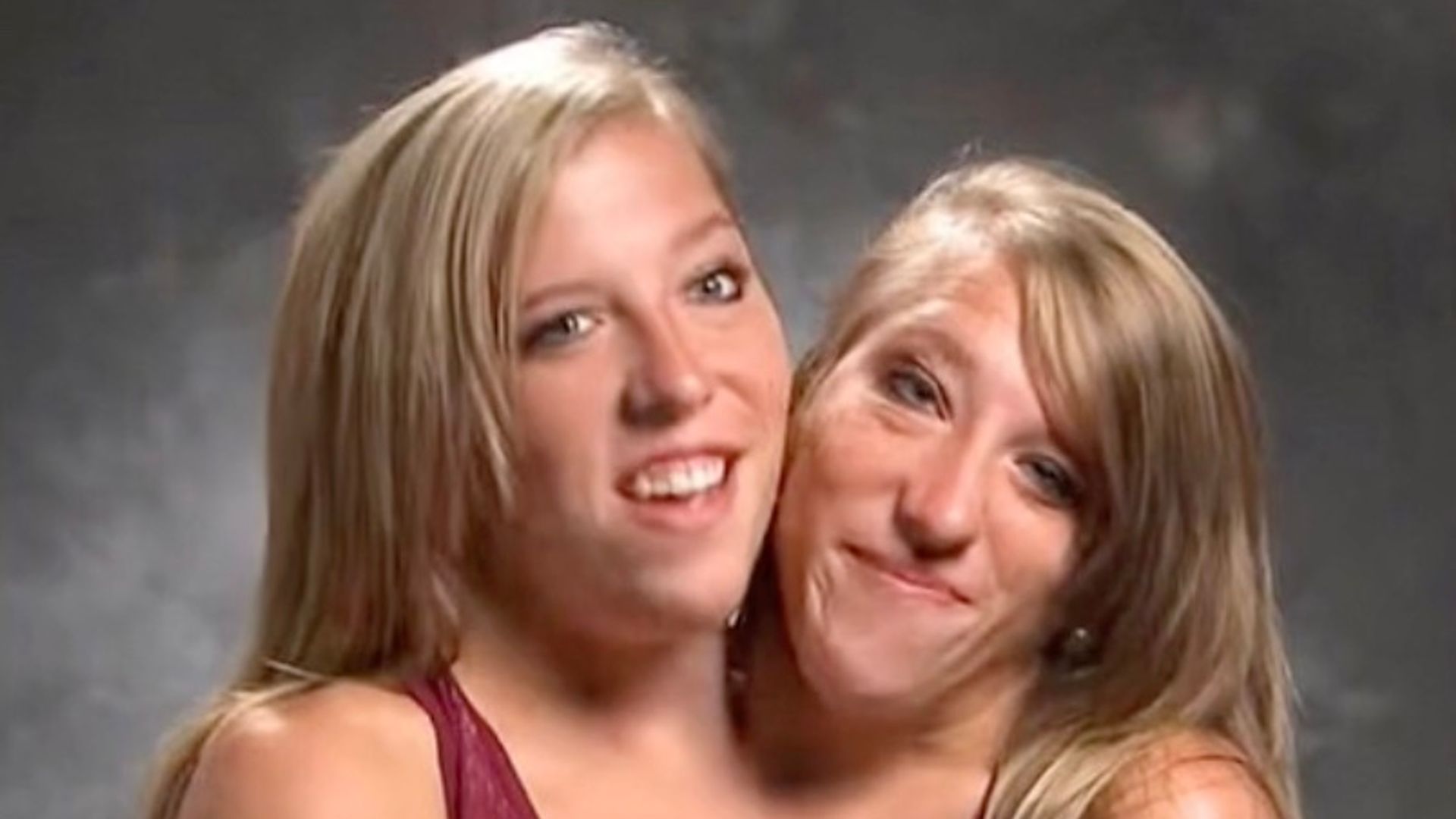 Abby and Brittany Hensel starred on the TLC reality TV show 