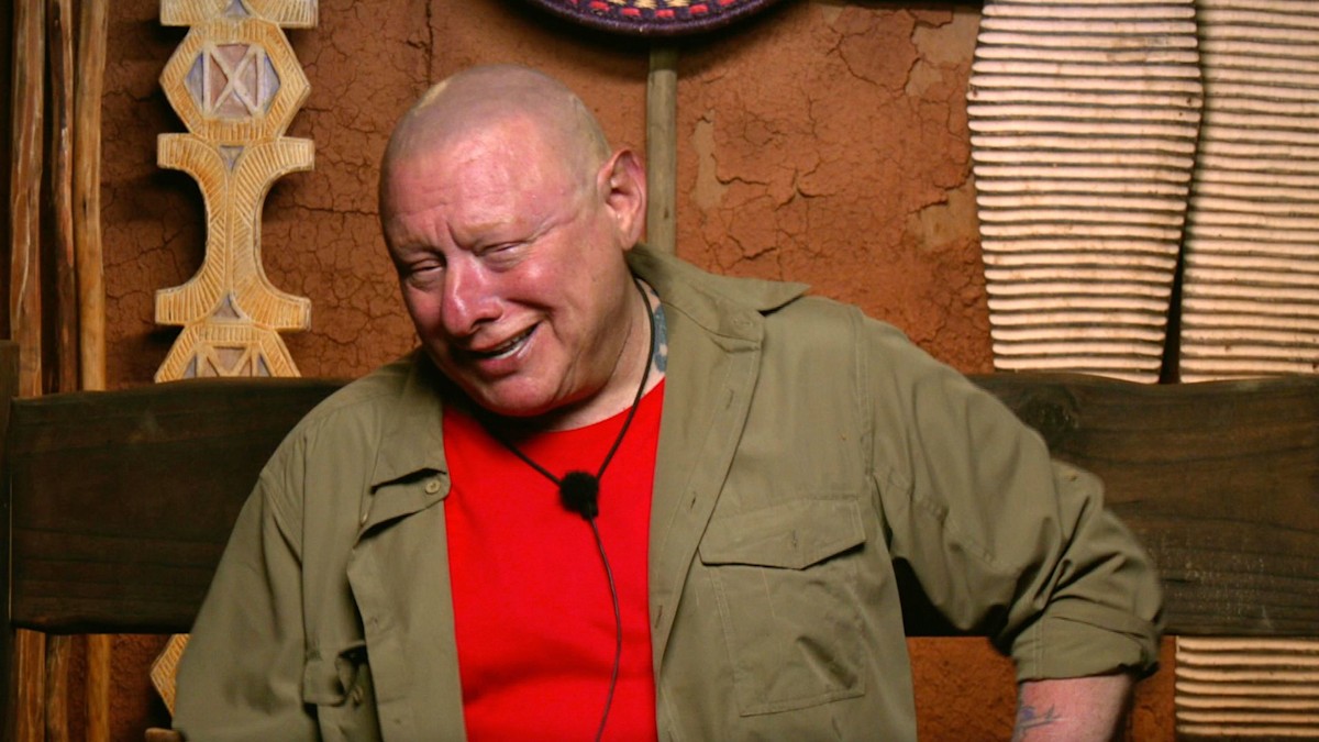 I'm A Celebrity star Shaun Ryder's health woes Alopecia, thyroid