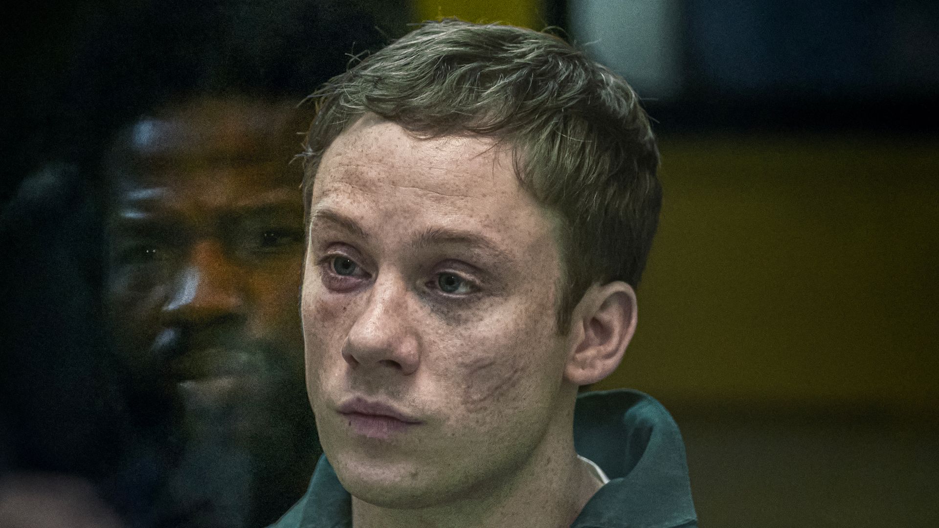 Man with bruised face in grey jumpsuit