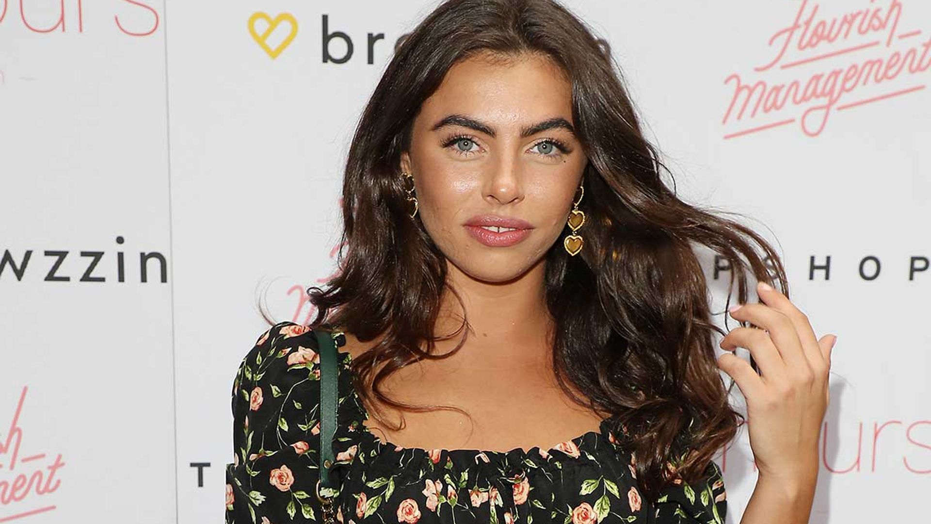 Love Island's Francesca Allen opens up about her acne scarring and ...