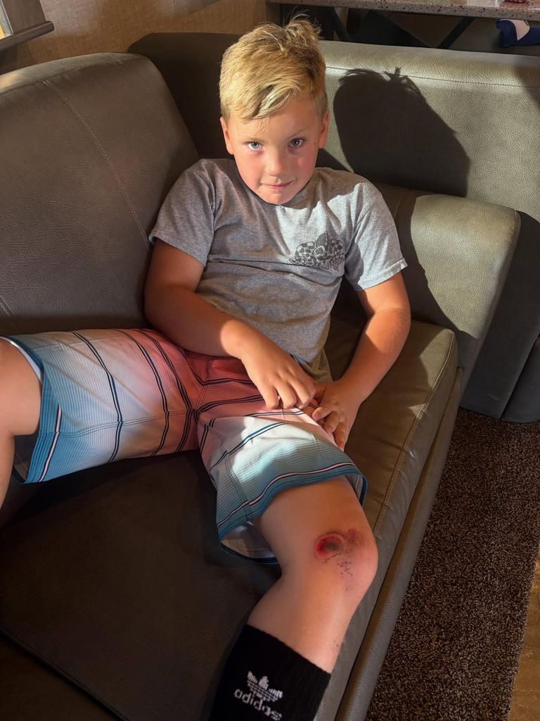 Jameson Hart reclining in the family's RV while nursing a scraped knee, shared on Instagram by Carey Hart