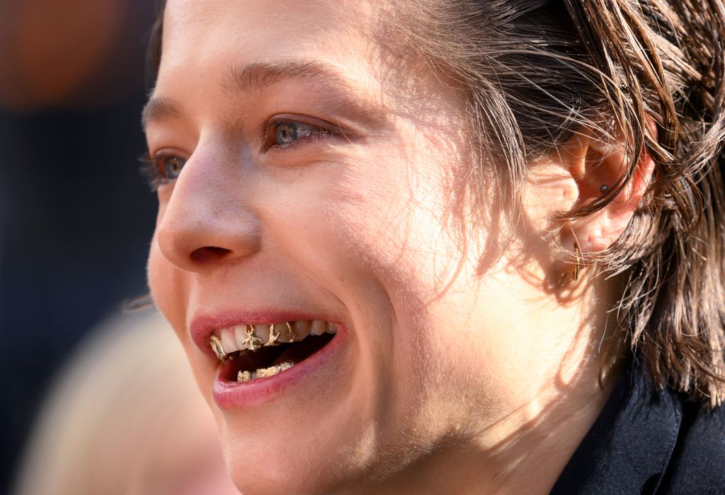 Emma D'Arcy gold grills in teeth