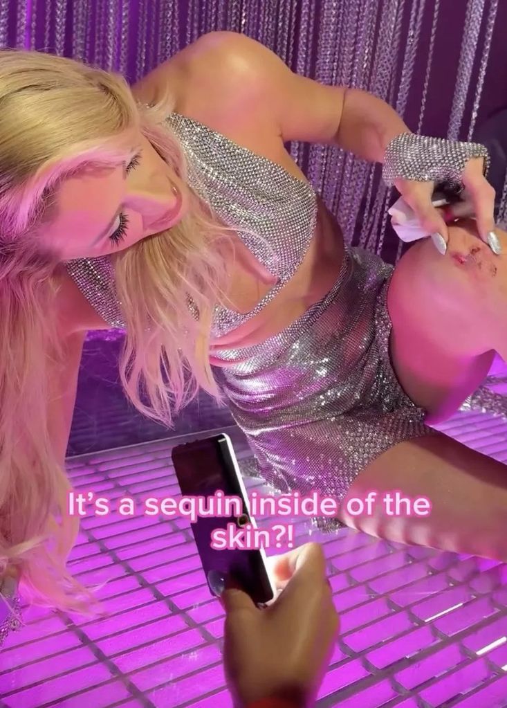 paris hilton cut knee filming music video