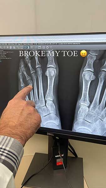 travis barker hospital x ray broken toe