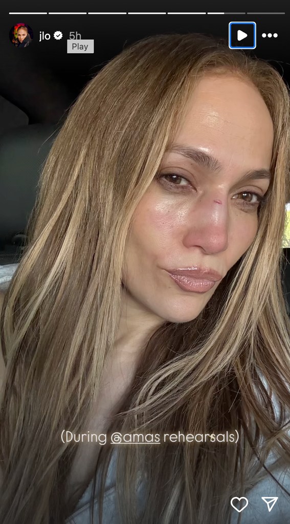 Selfie by Jennifer Lopez with a cut on the nose