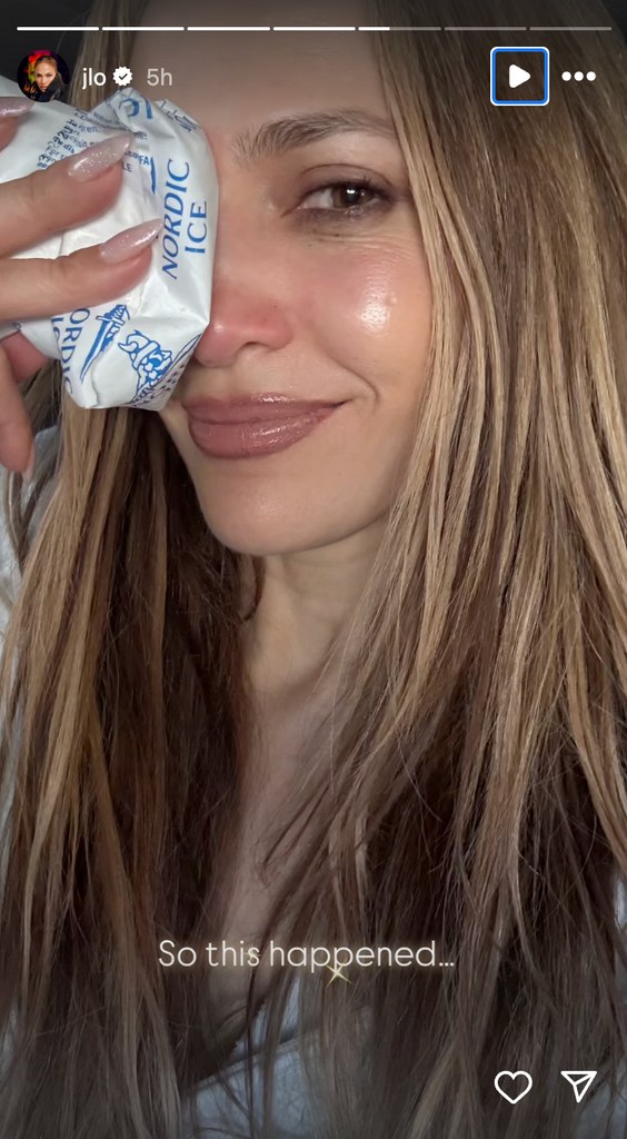 Selfie of Jennifer Lopez with ice pack