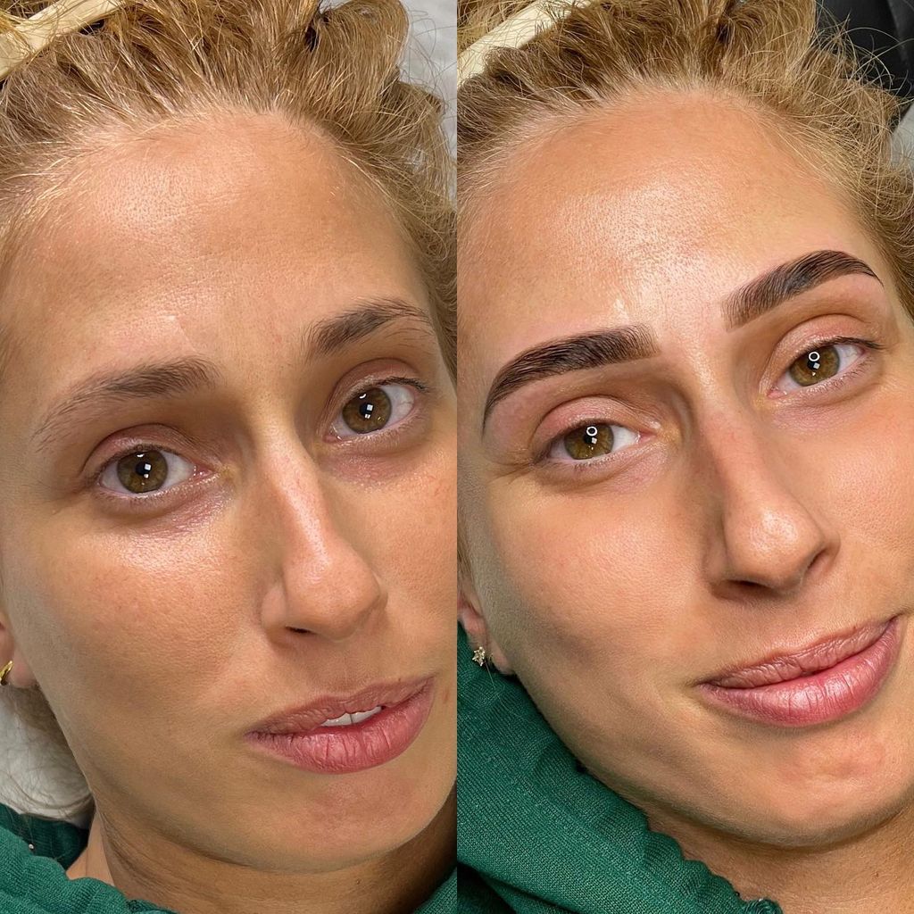 Stacey Solomon before and after photo 