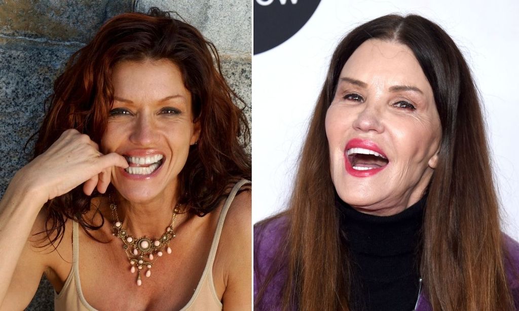 Janice Dickinson teeth before and after transformation