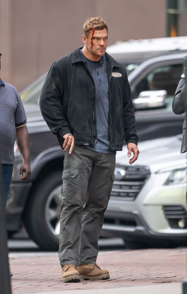 Alan on the set of Reacher bloodied head