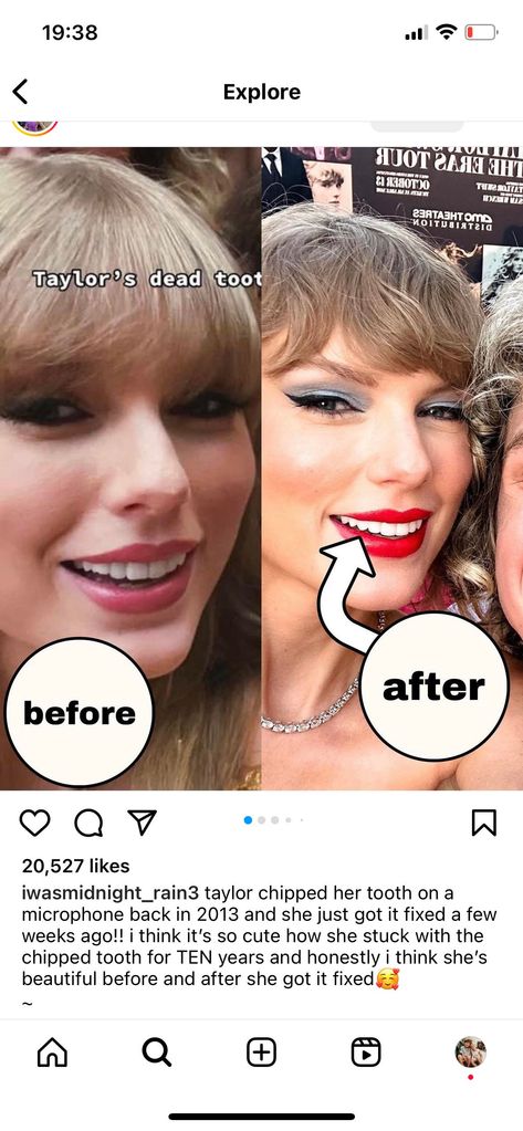 One fan posted before and after pics of Taylor's teeth