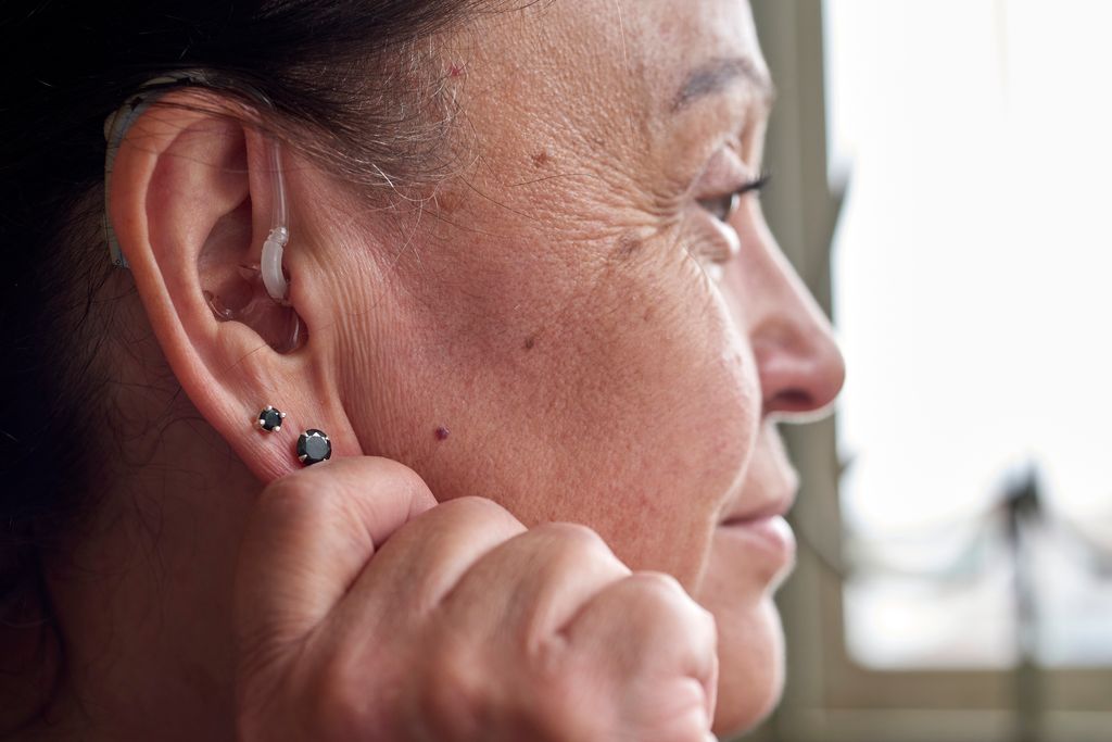 La perte auditive liée à l’âge peut-elle être inversée ? Un expert intervient 2 Les appareils auditifs sont une bonne option de traitement pour la perte auditive liée à l'âge