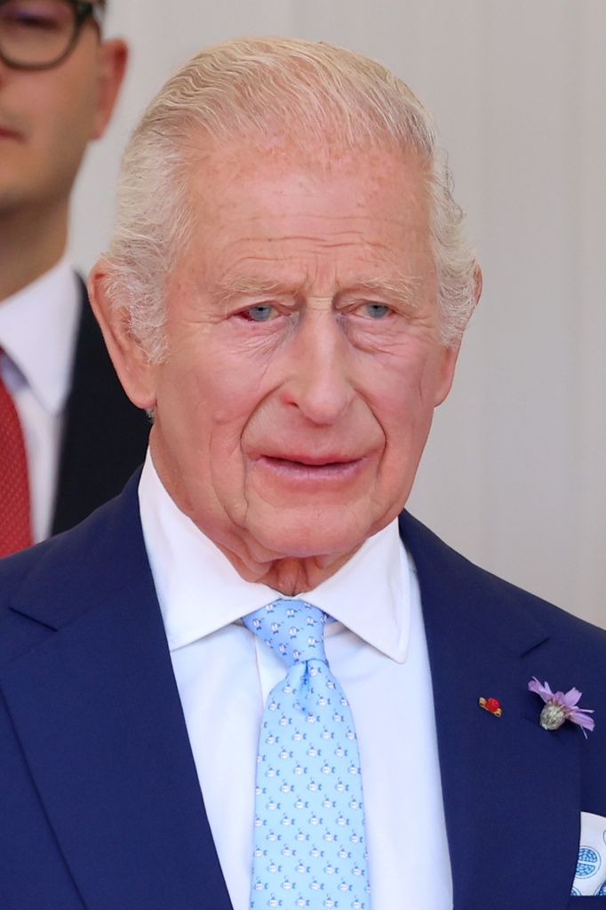 King Charles in a blue suit, there is a burst blood vessel in his left eye