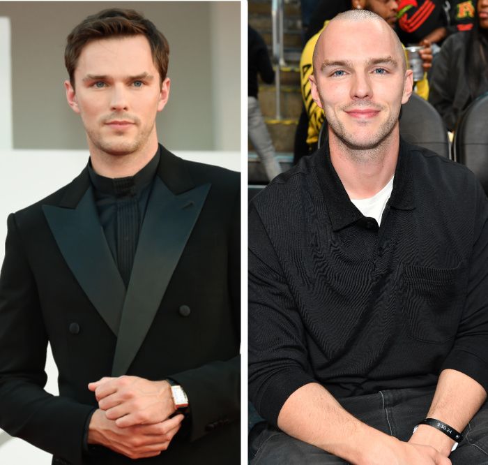 nicholas hoult as lex luthor before and after